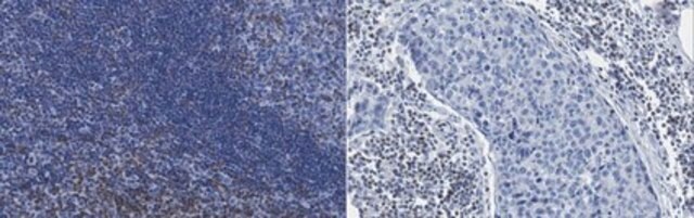 Anti-DAG Kinase Alpha Antibody, clone 10D6.1 clone 10D6.1, from mouse