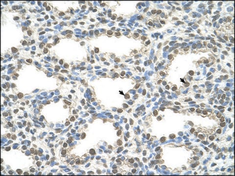 Anti-FOXQ1 antibody produced in rabbit affinity isolated antibody