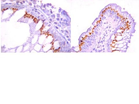 Anti-ROR2 Antibody, CT from rabbit