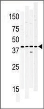 Anti-WNK1 (center) antibody produced in rabbit IgG fraction of antiserum, buffered aqueous solution