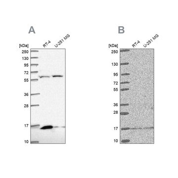 Anti-MRPS16 antibody produced in rabbit Prestige Antibodies&#174; Powered by Atlas Antibodies, affinity isolated antibody, buffered aqueous glycerol solution