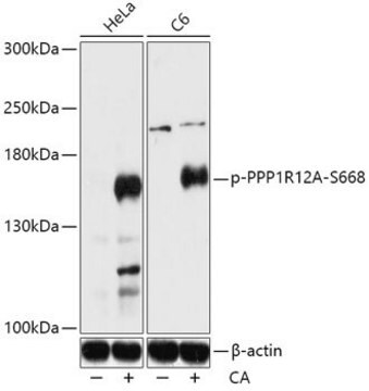 Anti-Phospho-PPP1R12A-S668 antibody produced in rabbit