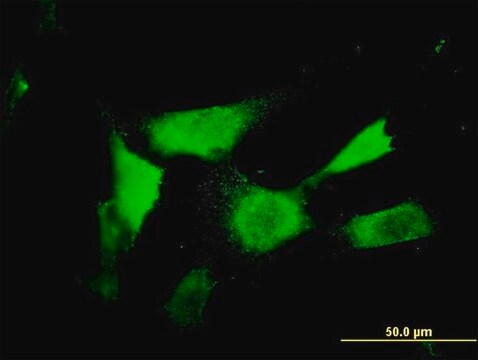 Monoclonal Anti-ASAHL antibody produced in mouse clone 5E3, purified immunoglobulin, buffered aqueous solution