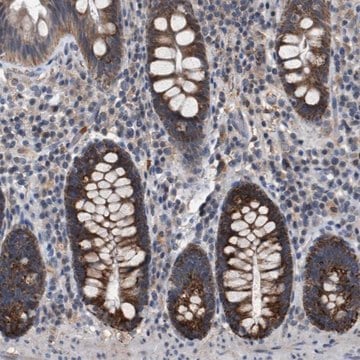 Anti-TECPR1 antibody produced in rabbit Prestige Antibodies&#174; Powered by Atlas Antibodies, affinity isolated antibody, buffered aqueous glycerol solution