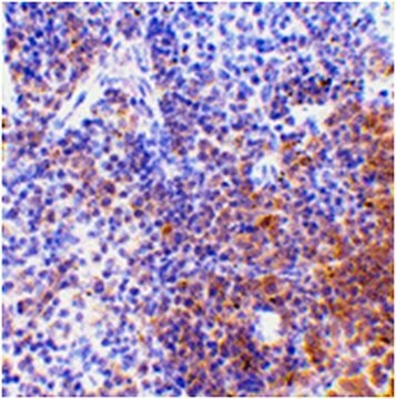 Anti-IRF7 Antibody from rabbit, purified by affinity chromatography