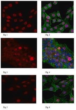 Anti-PIDD Antibody, clone 1511.1 clone 15F11.1, from mouse