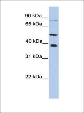 Anti-METTL2B (AB1) antibody produced in rabbit affinity isolated antibody