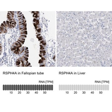 Anti-RSPH4A antibody produced in rabbit Prestige Antibodies&#174; Powered by Atlas Antibodies, affinity isolated antibody, buffered aqueous glycerol solution