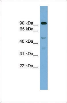 Anti-ZFY2 antibody produced in rabbit affinity isolated antibody