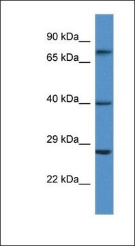 Anti-AGTR2 antibody produced in rabbit affinity isolated antibody