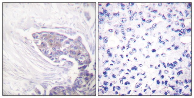 Anti-TRXR2 antibody produced in rabbit affinity isolated antibody