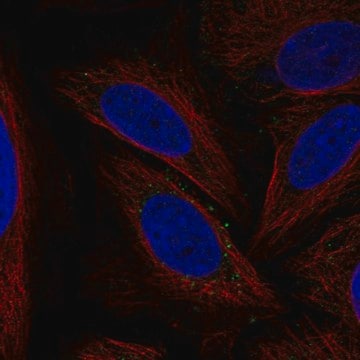 Anti-Atg12 Antibody Produced In Rabbit Prestige Antibodies&#174; Powered by Atlas Antibodies, affinity isolated antibody, buffered aqueous glycerol solution