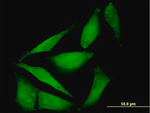 Anti-FBXO40 antibody produced in mouse purified immunoglobulin, buffered aqueous solution