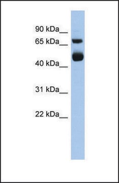 Anti-ALOX15 antibody produced in rabbit affinity isolated antibody