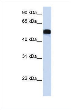 Anti-FOXA1 (ab2) antibody produced in rabbit affinity isolated antibody