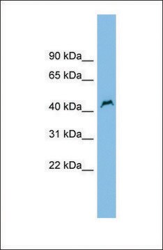 Anti-PNPLA1 antibody produced in rabbit affinity isolated antibody