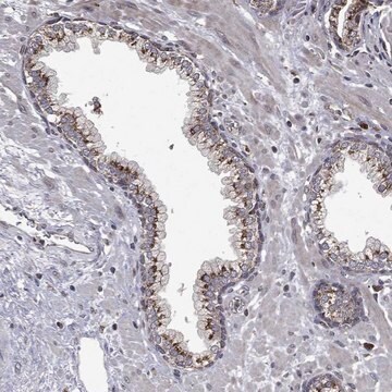 Anti-Plppr2 Antibody Produced In Rabbit Prestige Antibodies&#174; Powered by Atlas Antibodies, affinity isolated antibody, buffered aqueous glycerol solution