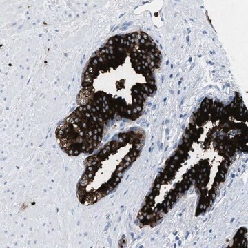 Anti-CMTM1 antibody produced in rabbit Prestige Antibodies&#174; Powered by Atlas Antibodies, affinity isolated antibody, buffered aqueous glycerol solution