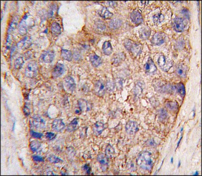 Anti-UBTD1 (C-term G195) antibody produced in rabbit Ig fraction of antiserum, buffered aqueous solution