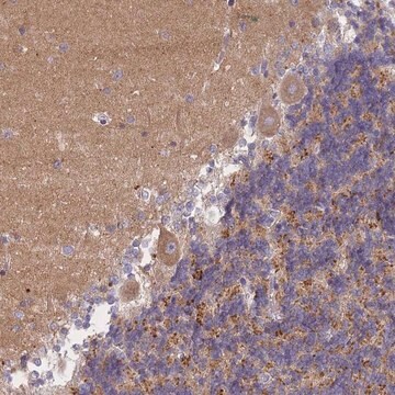 Anti-AP3M1 antibody produced in rabbit Prestige Antibodies&#174; Powered by Atlas Antibodies, affinity isolated antibody, buffered aqueous glycerol solution