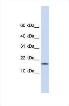 Anti-CENPA antibody produced in rabbit affinity isolated antibody