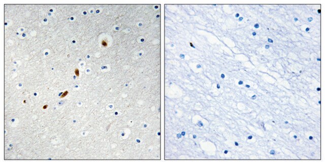 Anti-ZNF596 antibody produced in rabbit affinity isolated antibody