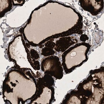 Anti-HIKESHI antibody produced in rabbit Prestige Antibodies&#174; Powered by Atlas Antibodies, affinity isolated antibody, buffered aqueous glycerol solution