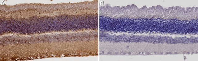 Anticuerpo anti-arrestina de cono retiniano Chemicon&#174;, from rabbit