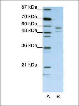 Anti-SARS (AB1) antibody produced in rabbit IgG fraction of antiserum