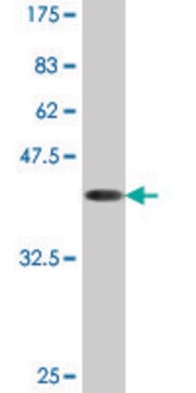 Monoclonal Anti-ACP1 antibody produced in mouse clone 2A3, purified immunoglobulin, buffered aqueous solution