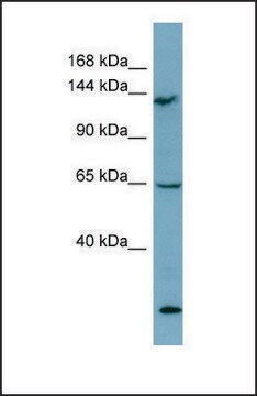 Anti-LATS1 antibody produced in rabbit affinity isolated antibody