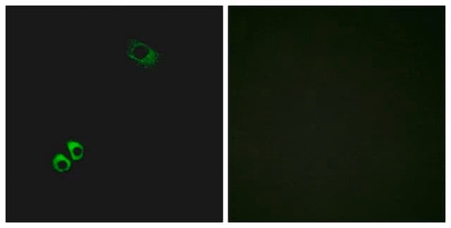 Anti-GPRC6A antibody produced in rabbit affinity isolated antibody