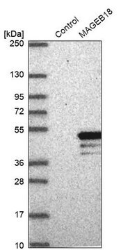 Anti-MAGEB18 antibody produced in rabbit Prestige Antibodies&#174; Powered by Atlas Antibodies, affinity isolated antibody, buffered aqueous glycerol solution