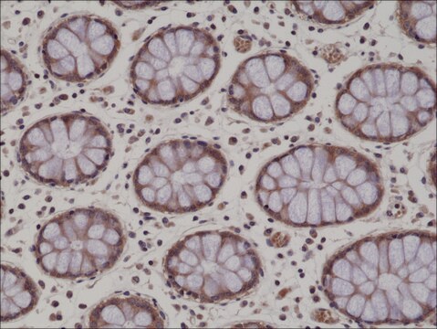 Anti-AMPK alpha-1antibody, Rabbit Monoclonal recombinant, expressed in HEK 293 cells, clone RM301, purified immunoglobulin