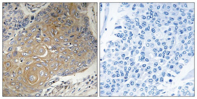 Anti-MRPS33 antibody produced in rabbit affinity isolated antibody