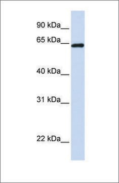 Anti-LCP1 (ab2) antibody produced in rabbit affinity isolated antibody