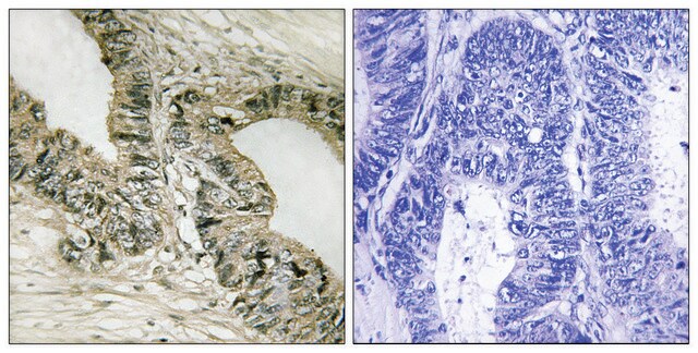 Anti-GAB2 antibody produced in rabbit affinity isolated antibody