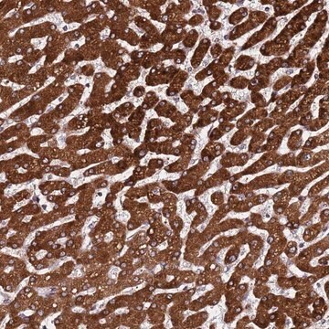 Anti-PPM1H antibody produced in rabbit Prestige Antibodies&#174; Powered by Atlas Antibodies, affinity isolated antibody, buffered aqueous glycerol solution