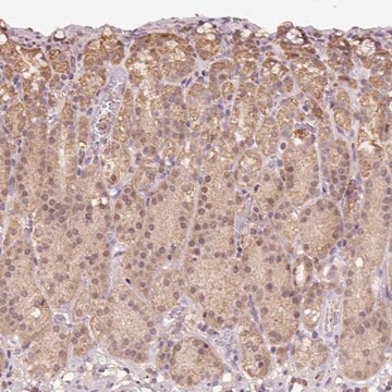 Anti-TMEM170B antibody produced in rabbit Prestige Antibodies&#174; Powered by Atlas Antibodies, affinity isolated antibody, buffered aqueous glycerol solution