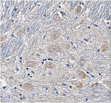 Anti-SUR1 Antibody, clone N289/16 clone N289/16, from mouse