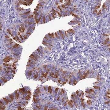 Anti-BBS2 antibody produced in rabbit Prestige Antibodies&#174; Powered by Atlas Antibodies, affinity isolated antibody, buffered aqueous glycerol solution