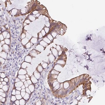 Anti-TRAM2 antibody produced in rabbit Prestige Antibodies&#174; Powered by Atlas Antibodies, affinity isolated antibody, buffered aqueous glycerol solution