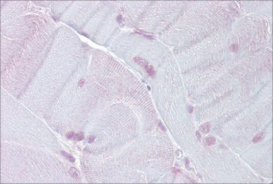 Anti-TEF antibody produced in rabbit affinity isolated antibody