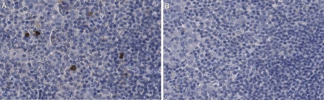 Anti-IL-1&#945; Antibody, clone 7E5.14.5