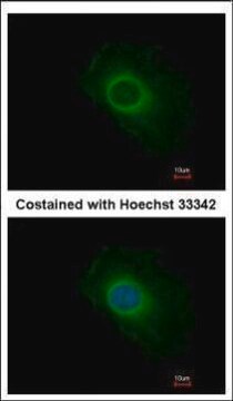 Anti-SERP1 antibody produced in rabbit affinity isolated antibody, buffered aqueous solution