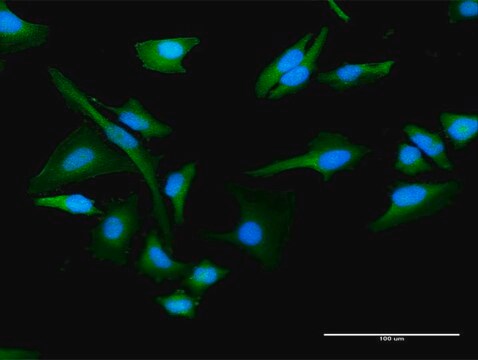 Anti-CHKA antibody produced in rabbit purified immunoglobulin, buffered aqueous solution