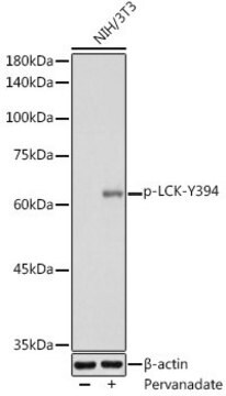 Anti-Phospho-LCK-Y394 antibody produced in rabbit