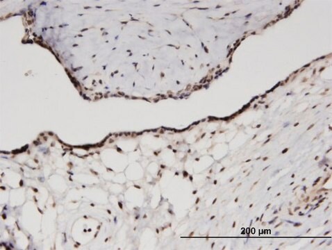 Monoclonal Anti-RPS11, (C-terminal) antibody produced in mouse clone 2A5, purified immunoglobulin, buffered aqueous solution