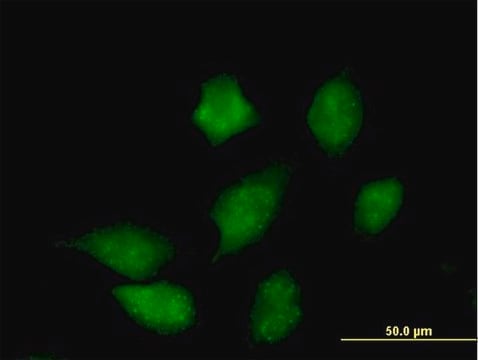 Anti-CMPK antibody produced in mouse purified immunoglobulin, buffered aqueous solution