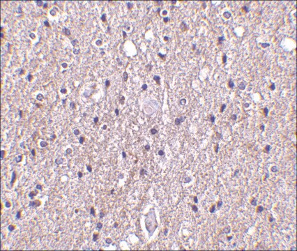 Anti-CTRP4 (ab2) antibody produced in rabbit affinity isolated antibody, buffered aqueous solution